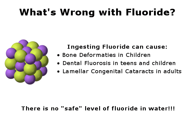 fluoride-health-effects Harmful effects of fluoride infographic